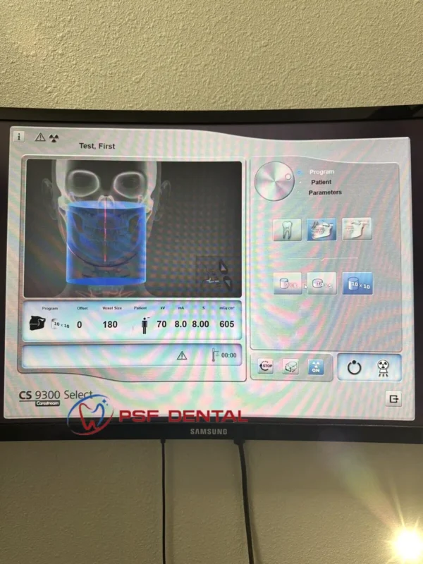 Carestream CS 9300