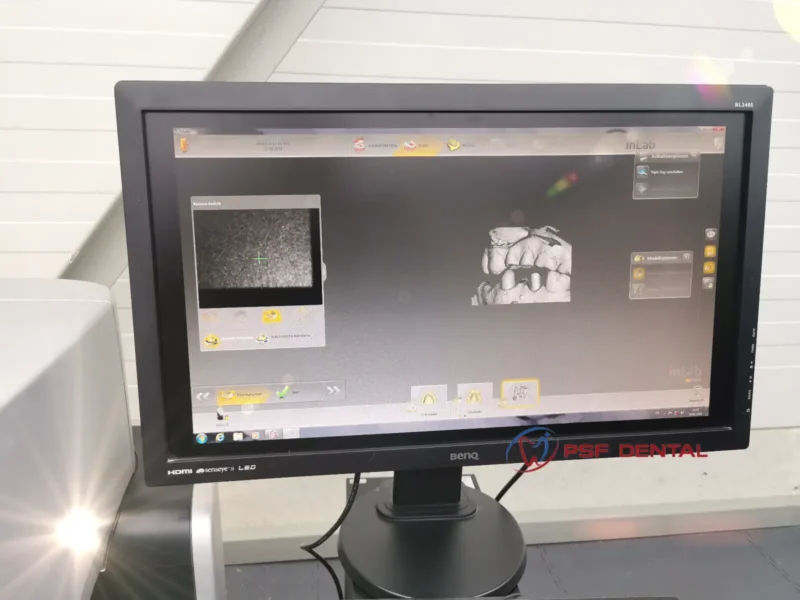 Sirona inEos X5 Digital Dental Lab Scanner - Image 5