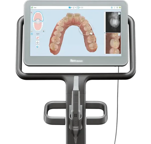 iTero Element 5D Scanner Imaging System